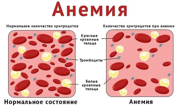 Мойва. Польза и вред для организма беременных женщин, мужчин, похудения. Как приготовить